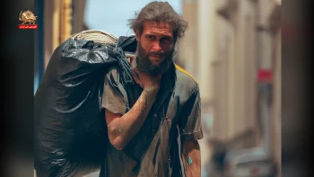 شعر کی مانده؟